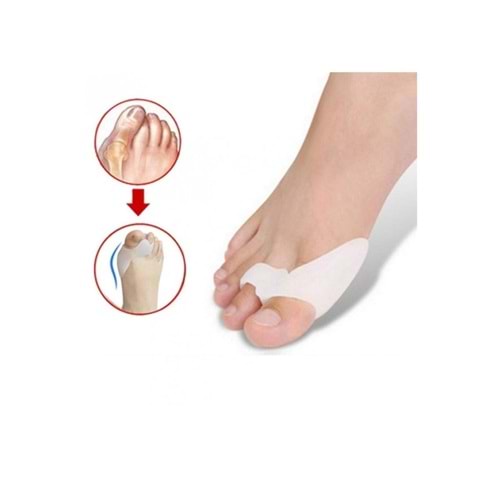 ABC SOFTSTEP SİLİKON HALLUKS VALGUS VE BUNION KORUYUCU PED ( 1 ÇİFT / SS 032 A )